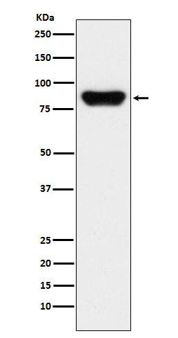 Prothrombin Rabbit mAb