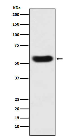 SERPINC1 Rabbit mAb 