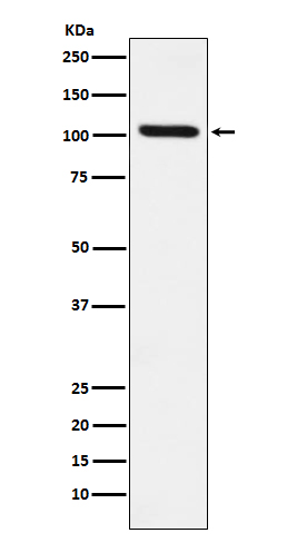 DDX58 Rabbit mAb