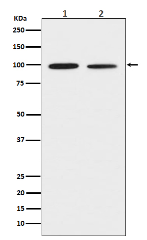 DDR2 Rabbit mAb