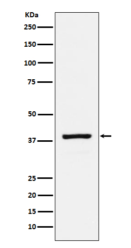 RASSF1 Rabbit mAb