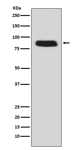 GCSF Receptor (CD114) Rabbit mAb