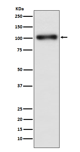 GABA B Receptor 1 Rabbit mAb