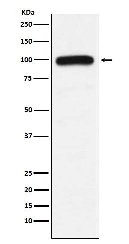 UBE3A Rabbit mAb