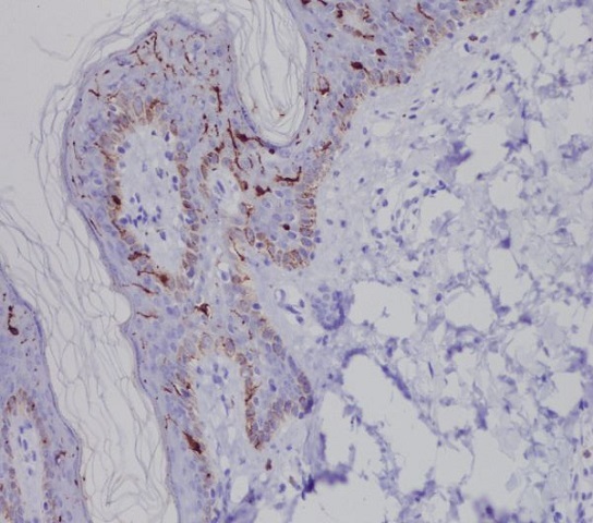 Langerin (CD207) Rabbit mAb 