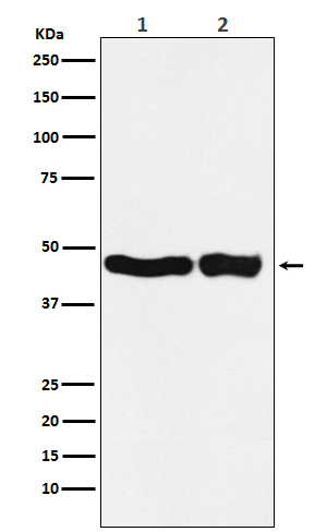 UQCRC2 Rabbit mAb 