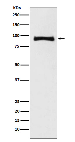 MALT1 Rabbit mAb 