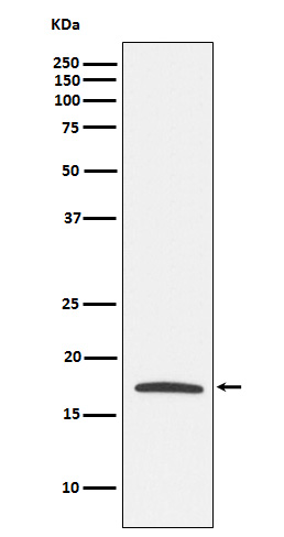 Claudin 4 Rabbit mAb 