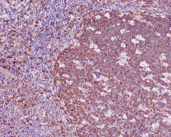 beta I Tubulin Rabbit mAb