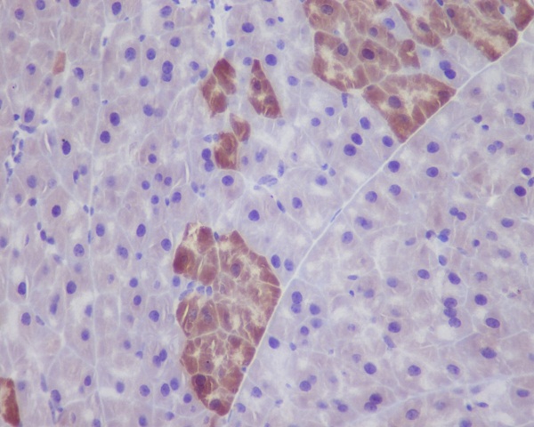 GFP Rabbit mAb