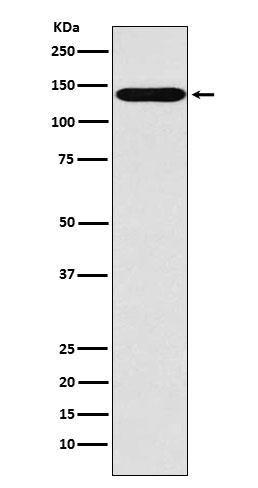 SLC9A1 Rabbit mAb