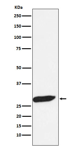 FHL1 Rabbit mAb