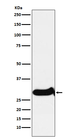 IGFBP7 Rabbit mAb