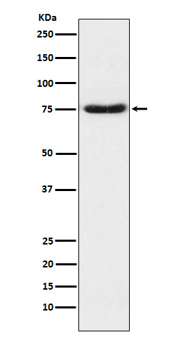 Netrin 1 Rabbit mAb