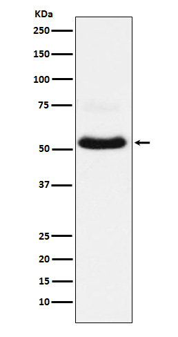 VGLUT1 Rabbit mAb