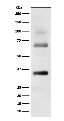 Loricrin Rabbit mAb