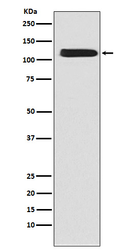 NCX1 Rabbit mAb