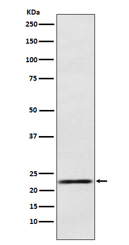 Prolactin Rabbit mAb