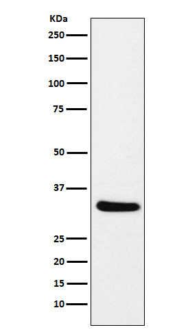 CRALBP Rabbit mAb