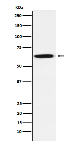 GRB7 Rabbit mAb
