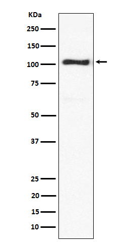 ACTN3 Rabbit mAb