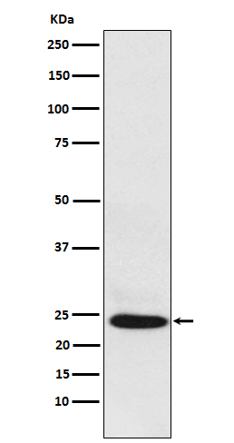BAG2 Rabbit mAb
