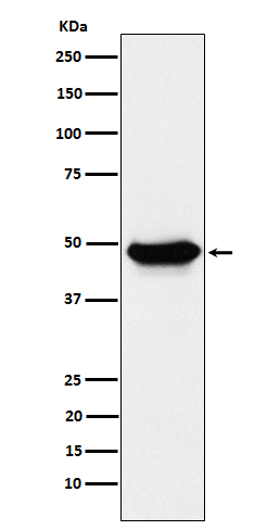 ENTPD5 Rabbit mAb