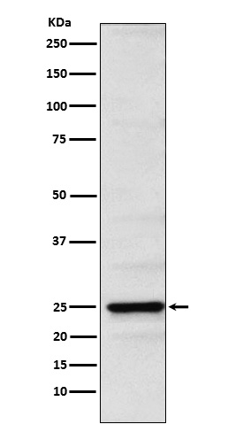Neurogenin 2 Rabbit mAb