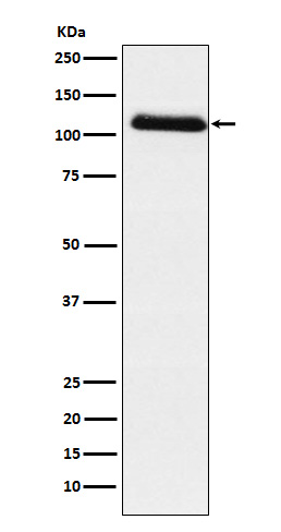 Fibrinogen alpha chain Rabbit mAb