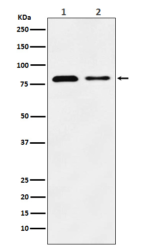 LIMPII Rabbit mAb