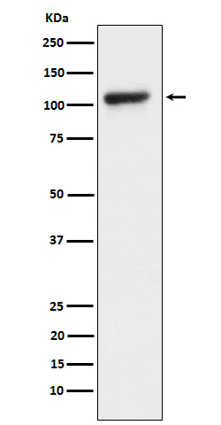 KDM1 / LSD1 Rabbit mAb
