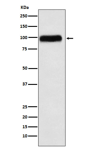 SERPING1 Rabbit mAb