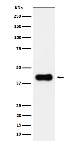 ACAA2 Rabbit mAb