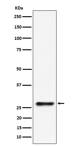 SBDS Rabbit mAb
