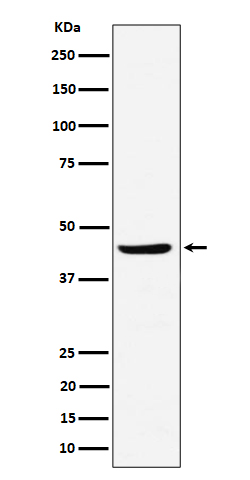 NDRG3 Rabbit mAb