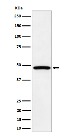 PTPN1/2 Rabbit mAb