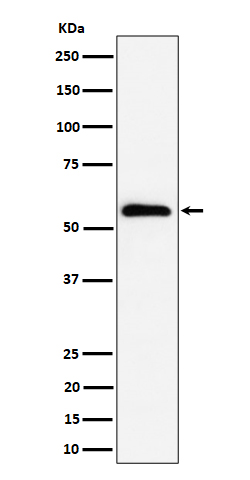 PNK / PNKP Rabbit mAb