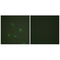 PR Polyclonal Antibody