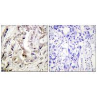 PR Polyclonal Antibody