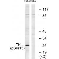 TK (Phospho-Ser13) Antibody