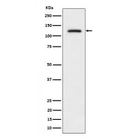 ULK1 (Phospho-Ser556) Rabbit mAb