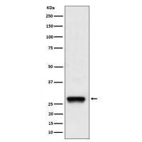 PDGF B Rabbit mAb
