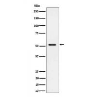 SEC62 Rabbit mAb