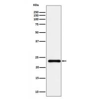 HSPC150 Rabbit mAb