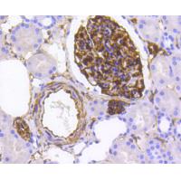 Nestin Rabbit mAb