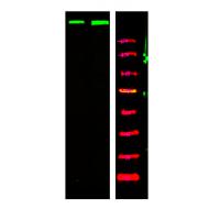 ATM (Phospho-Ser367) Antibody