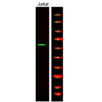 CAMKK1/2 (Phospho-Ser458/495) Antibody