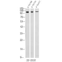 FGFR3 (Phospho-Tyr760) Antibody
