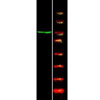 Androgen Receptor (Phospho-Ser81) Antibody