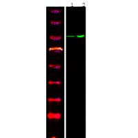 Androgen Receptor (Phospho-Tyr267) Antibody